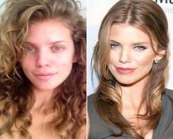 AnnaLynne McCord before surgery